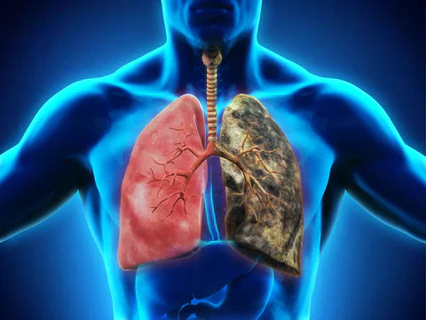 O Caminho da Recuperação: Superando Doenças Pulmonares para Respirar Melhor